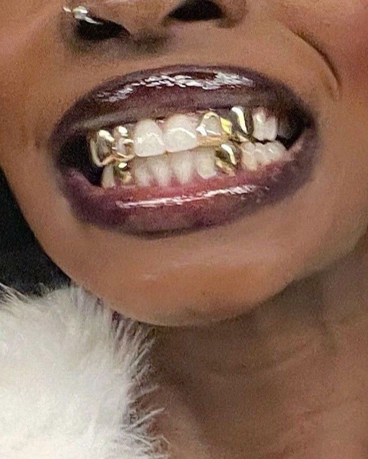 Top 4 with 2 open face and bottom 2 grillz